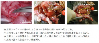 ナノ絆創膏に新たな可能性 腸の癒着防止効果も発見 臨床検査技師の求人 転職の検査技師人材バンク